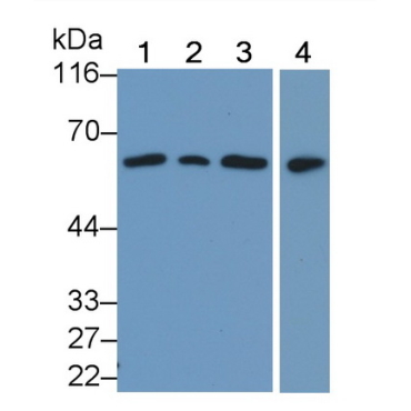 Phosphatase And Tensin Homolog (PTEN) Human Polyclonal Antibody