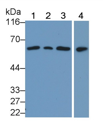 Phosphatase And Tensin Homolog (PTEN) Human Polyclonal Antibody