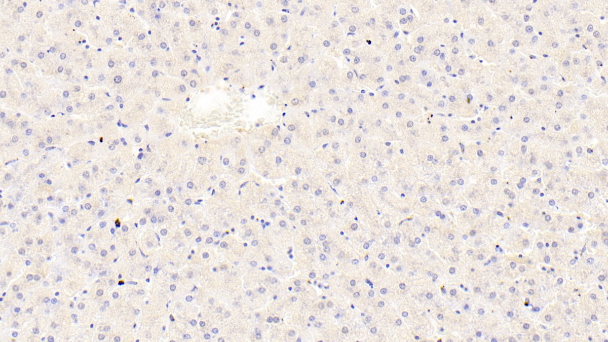Transient Receptor Potential Cation Channel Subfamily A, Member 1 (TRPA1) Human Polyclonal Antibody