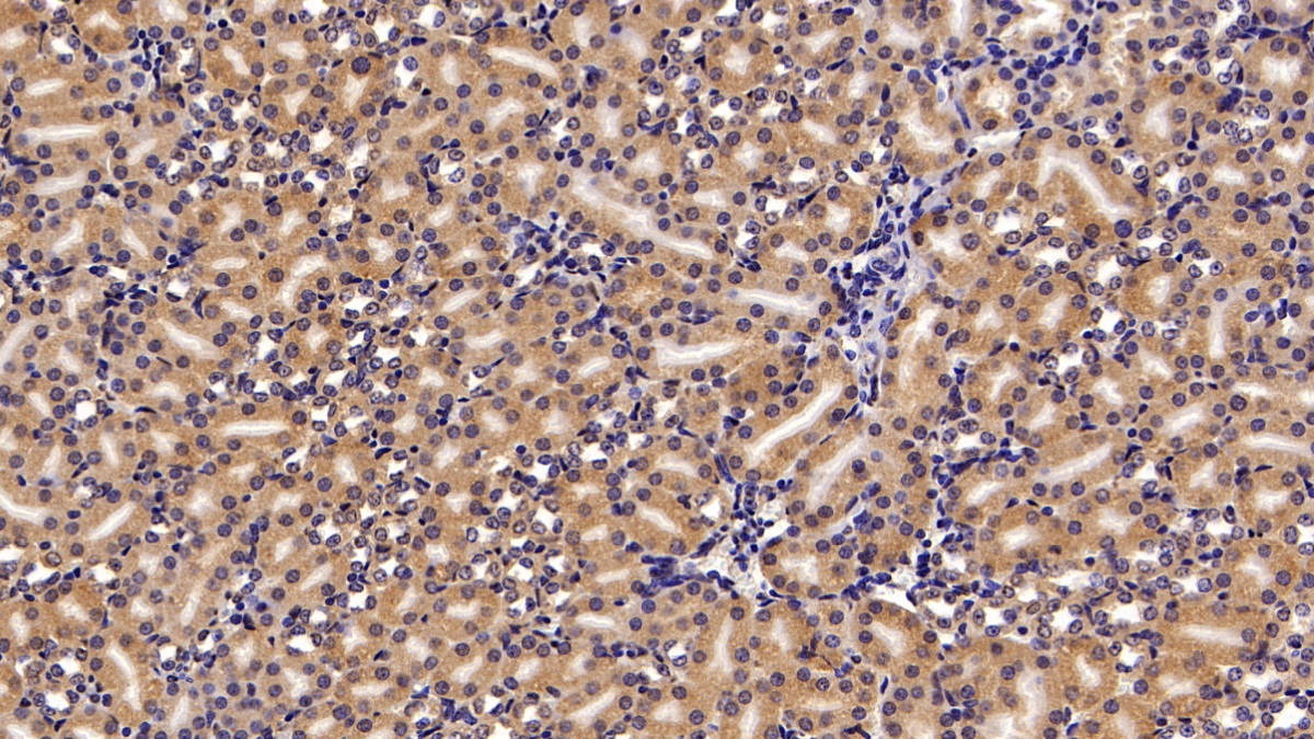 Transient Receptor Potential Cation Channel Subfamily M, Member 4 (TRPM4) Mouse Polyclonal Antibody