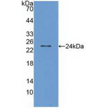 Transient Receptor Potential Cation Channel Subfamily V, Member 1 (TRPV1) Human Polyclonal Antibody