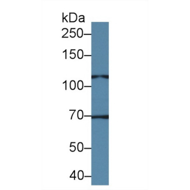 Transient Receptor Potential Cation Channel Subfamily C, Member 6 (TRPC6) Human Polyclonal Antibody