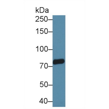 Transient Receptor Potential Cation Channel Subfamily V, Member 3 (TRPV3) Human Polyclonal Antibody