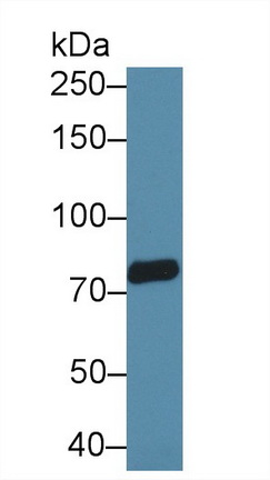 Transient Receptor Potential Cation Channel Subfamily V, Member 3 (TRPV3) Human Polyclonal Antibody