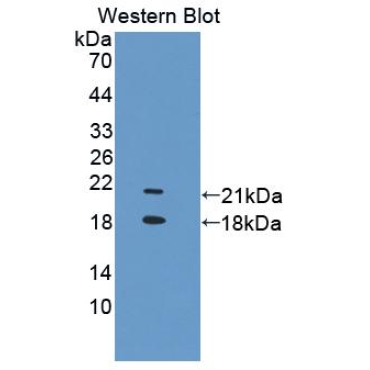 Transient Receptor Potential Cation Channel Subfamily V, Member 6 (TRPV6) Human Polyclonal Antibody