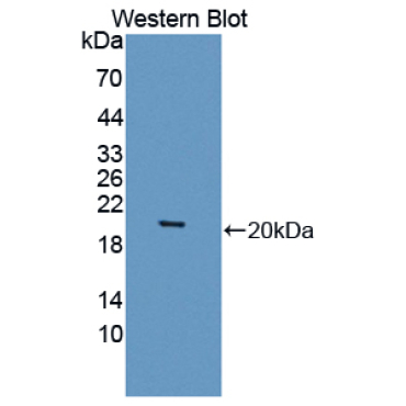 Septin 6 (SEPT6) Human Polyclonal Antibody