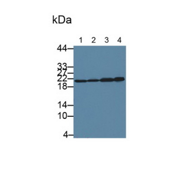 S-Phase Kinase Associated Protein 1 (SKP1) Human Polyclonal Antibody