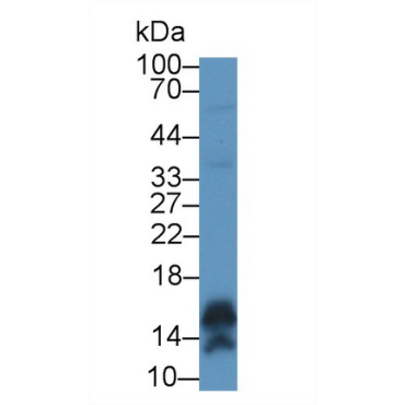Calmodulin Like Protein 5 (CALML5) Human Polyclonal Antibody