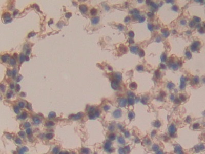 Sclerostin Domain Containing Protein 1 (SOSTDC1) Mouse Polyclonal Antibody