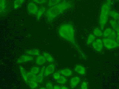 Ribonucleotide Reductase M1 (RRM1) Human Polyclonal Antibody