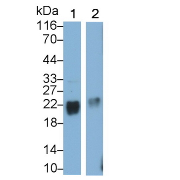 Stathmin 2 (STMN2) Human Polyclonal Antibody