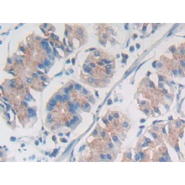 Nesprin 1 (Nesp1) Human Polyclonal Antibody