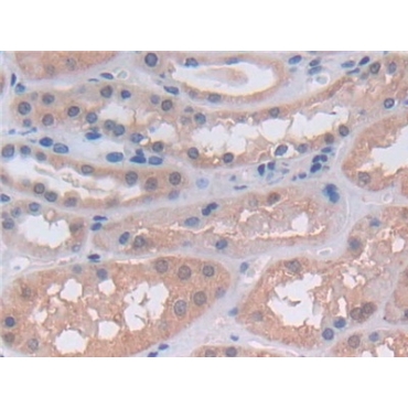 Utrophin (UTRN) Human Polyclonal Antibody