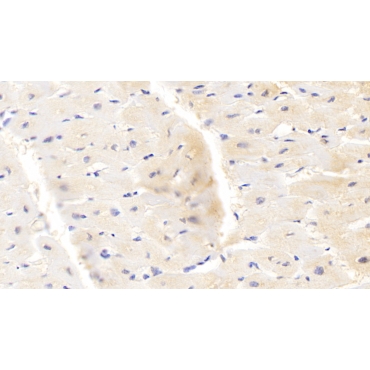 Protoporphyrinogen Oxidase (PPOX) Human Polyclonal Antibody