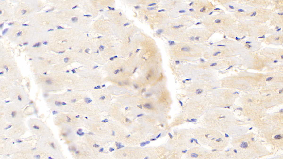 Protoporphyrinogen Oxidase (PPOX) Human Polyclonal Antibody