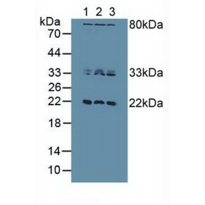 Dual Specificity Phosphatase 3 (DUSP3) Human Polyclonal Antibody