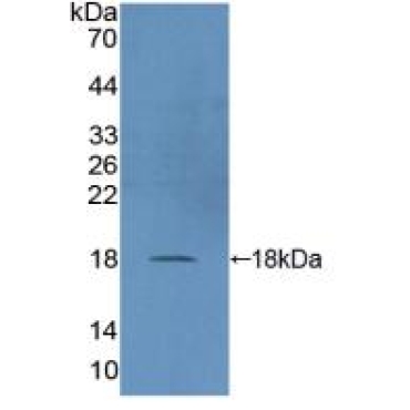 Dual Specificity Phosphatase 5 (DUSP5) Human Polyclonal Antibody