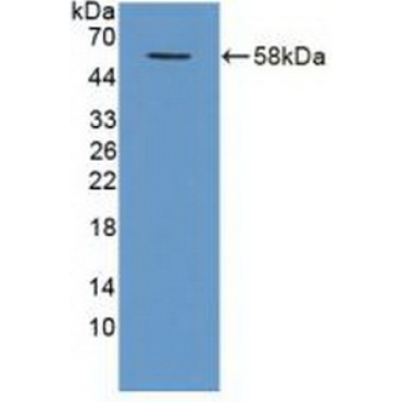TNF Receptor Associated Factor 1 (TRAF1) Human Polyclonal Antibody