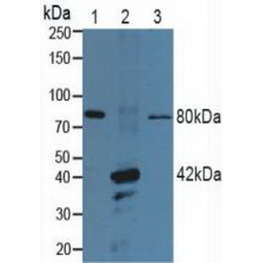 Purinergic Receptor P2X, Ligand Gated Ion Channel 7 (P2RX7) Human Polyclonal Antibody