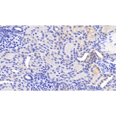 Adaptor Related Protein Complex 2 Mu 1 (AP2m1) Human Polyclonal Antibody