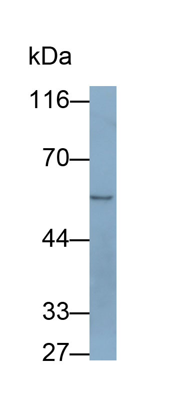 Tyrosyl tRNA Synthetase 2, Mitochondrial (YARS2) Human Polyclonal Antibody