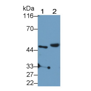 Prolyl tRNA Synthetase 2, Mitochondrial (PARS2) Human Polyclonal Antibody