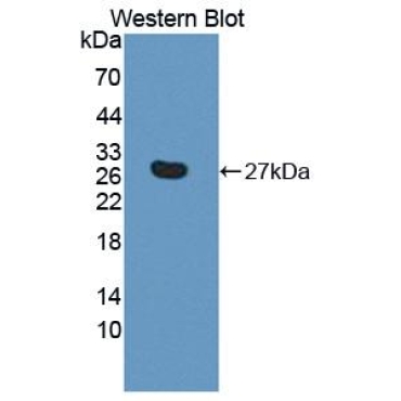 Aspartate Beta Hydroxylase (ASPH) Human Polyclonal Antibody