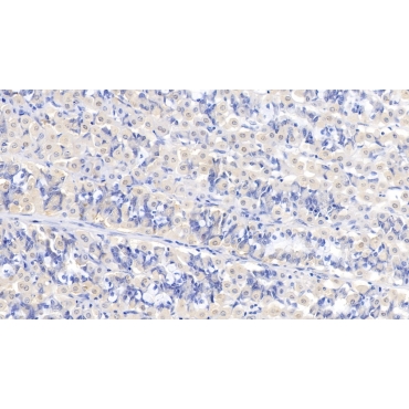 Aspartate Beta Hydroxylase (ASPH) Human Polyclonal Antibody