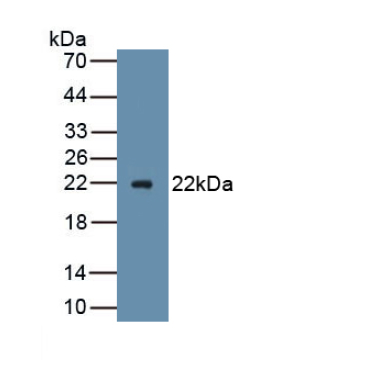 Advillin (AVIL) Mouse Polyclonal Antibody