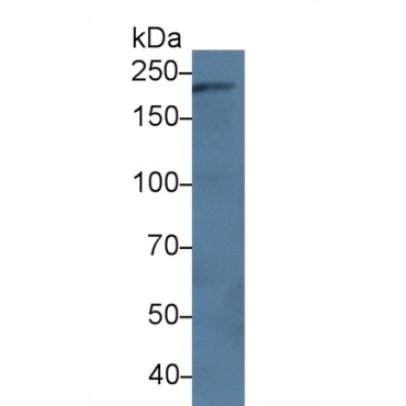Dedicator Of Cytokinesis 2 (DOCK2) Human Polyclonal Antibody