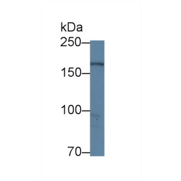 Dedicator Of Cytokinesis 4 (DOCK4) Human Polyclonal Antibody