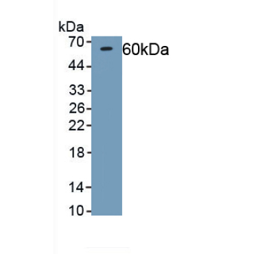 Podocan (PODN) Human Polyclonal Antibody