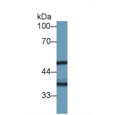 N-Acetyltransferase 1 (NAT1) Mouse Polyclonal Antibody