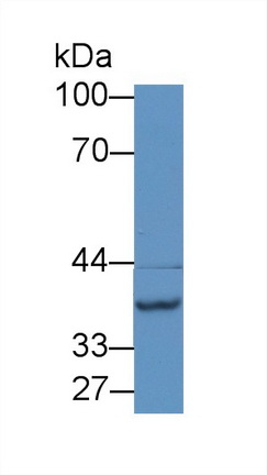 N-Acetyltransferase 2 (NAT2) Rat Polyclonal Antibody