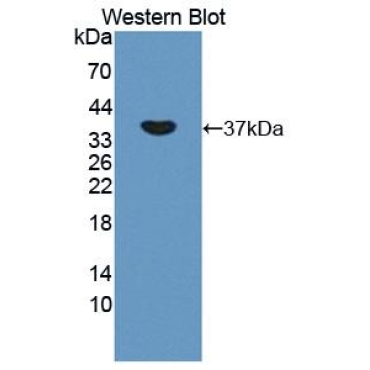 Oxidative Stress Induced Growth Inhibitor 1 (OSGIN1) Human Polyclonal Antibody