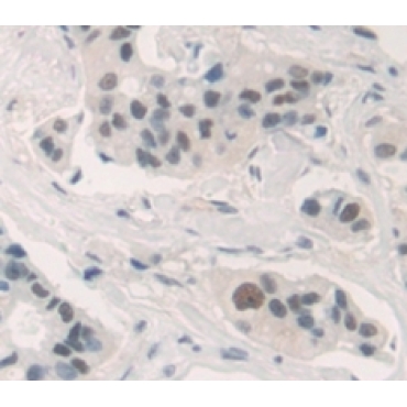 Forkhead Box Protein A1 (FOXA1) Human Polyclonal Antibody
