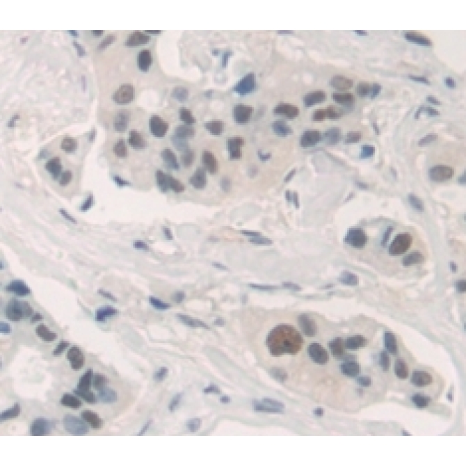 Forkhead Box Protein A1 (FOXA1) Human Polyclonal Antibody