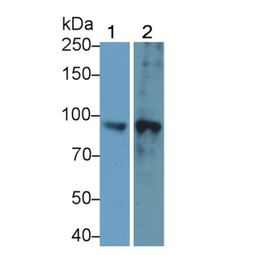 Forkhead Box Protein P2 (FOXP2) Human Polyclonal Antibody
