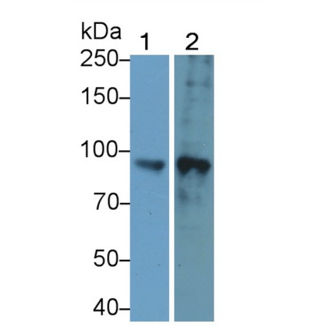 Forkhead Box Protein P2 (FOXP2) Human Polyclonal Antibody