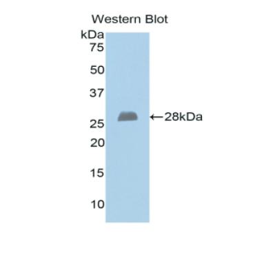 Exostoses 1 (EXT1) Human Polyclonal Antibody