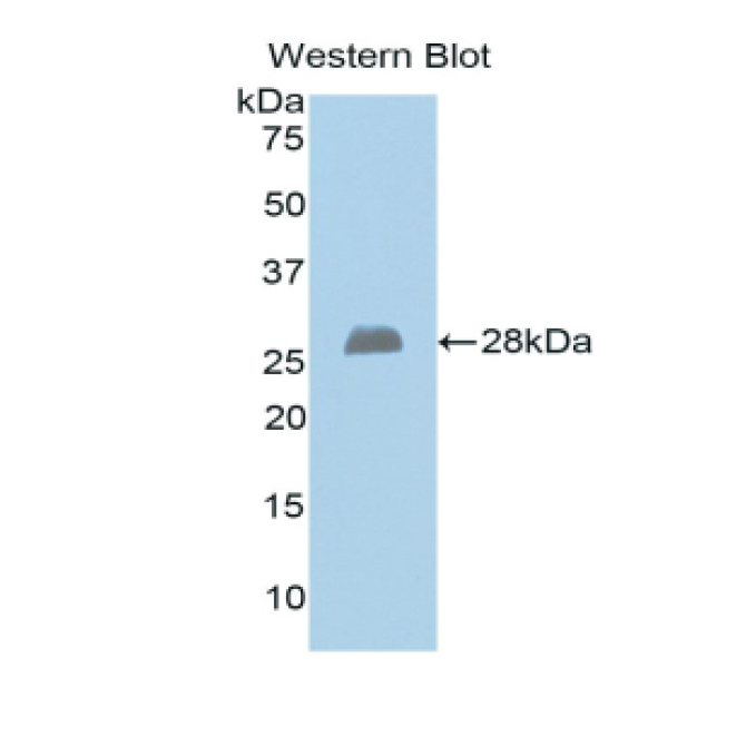 Exostoses 1 (EXT1) Human Polyclonal Antibody