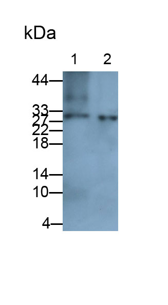 Proteasome Subunit Alpha Type 7 (PSMa7) Human Polyclonal Antibody