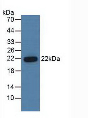 Proteasome Subunit Beta Type 6 (PSMb6) Human Polyclonal Antibody