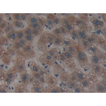 Proteasome 26S Subunit, ATPase 6 (PSMC6) Human Polyclonal Antibody