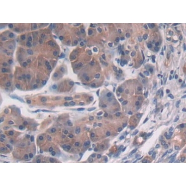 Proteasome 26S Subunit, Non ATPase 2 (PSMD2) Human Polyclonal Antibody