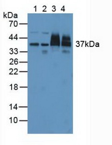 Proteasome 26S Subunit, Non ATPase 7 (PSMD7) Human Polyclonal Antibody