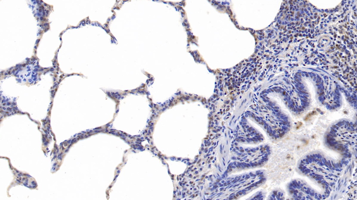 Proteasome Activator Subunit 3 (PSME3) Human Polyclonal Antibody