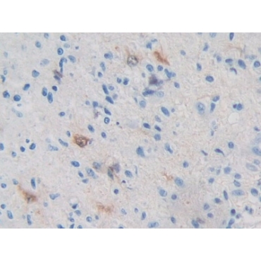 Protein Kinase, AMP Activated Beta 2 (PRKAb2) Human Polyclonal Antibody