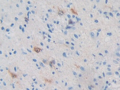 Protein Kinase, AMP Activated Beta 2 (PRKAb2) Human Polyclonal Antibody