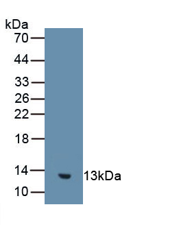 Guanylate Cyclase Activator 2B (GUCA2B) Human Polyclonal Antibody